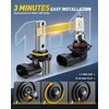 image:imageAUXITO 9006HB4 LED Switchback Bulbs 6500K White amp 3000K Amber Yellow 1000 50000LM Ultra Bright No Flicker 3MinPlug and Play 30 Years Lifespan Fits 99 Vehicles Pack of 29006HB4 Dual Color Bulb